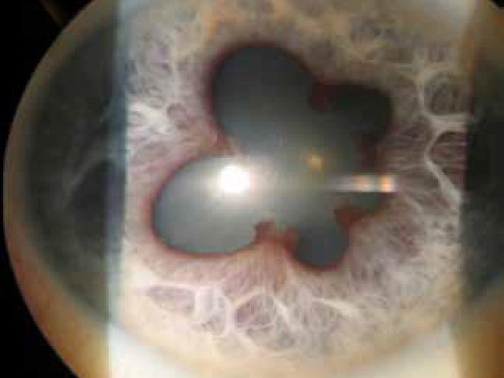 patologie oculari diagnosi sintomi cure
