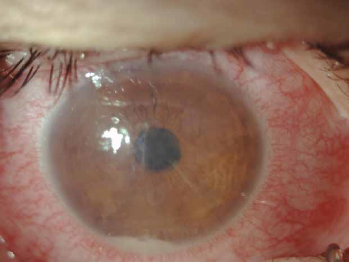 patologie oculari cura definitiva