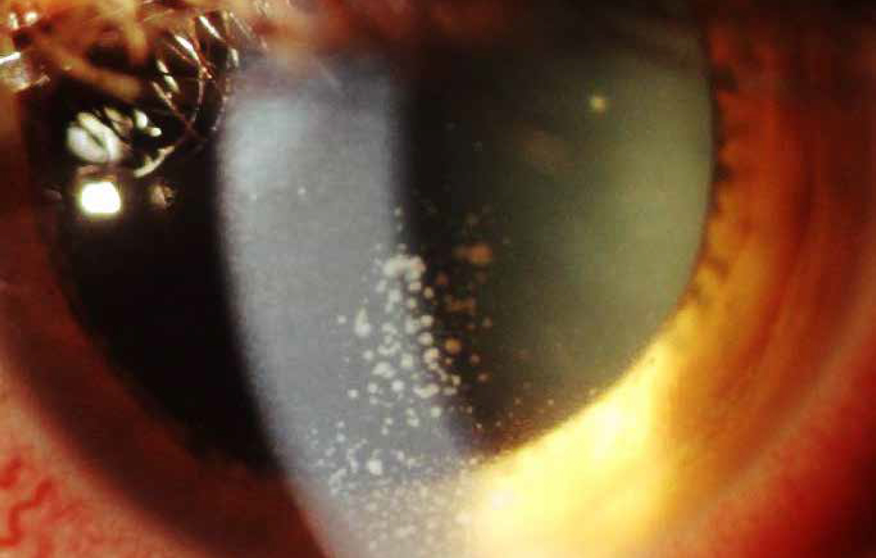 patologie oculari centro specialistico di riferimento