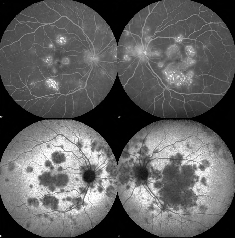 uveite diagnosi sintomi cure